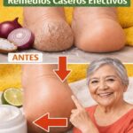 Adiós a los Talones Secos y Agrietados con Soluciones Naturales que Transforman tus Pies