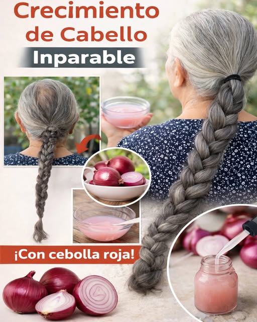 Aceite de cebolla roja para el crecimiento del cabello