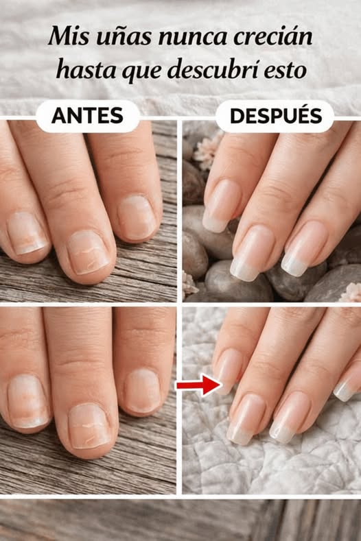 Antes y Después del Crecimiento de Uñas