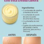 Suaviza tus talones y despídete de las grietas con esta crema casera